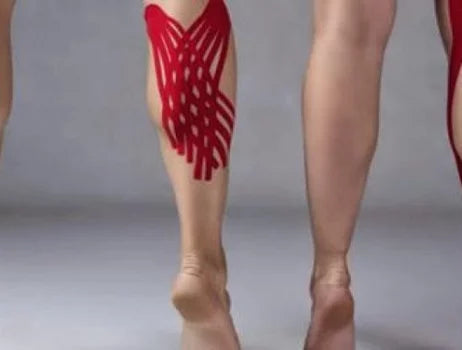 Roturas y desgarros musculares: una de las principales lesiones del pádel